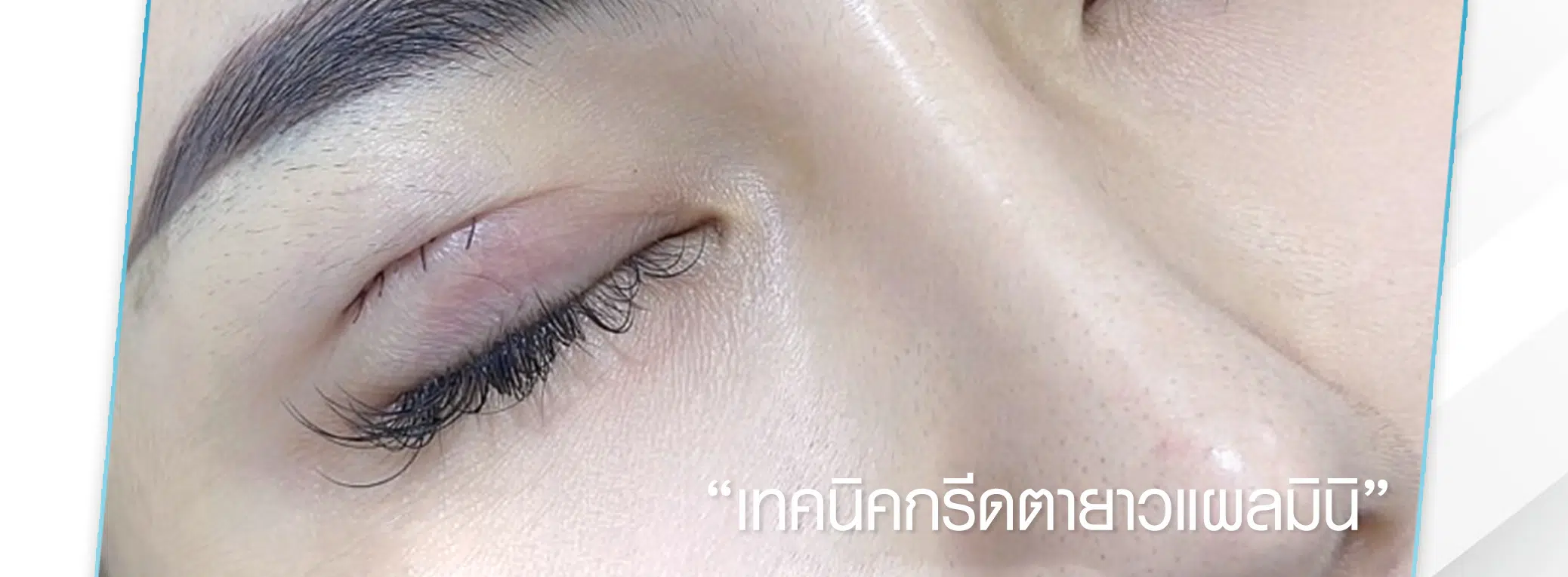 gallery-item
