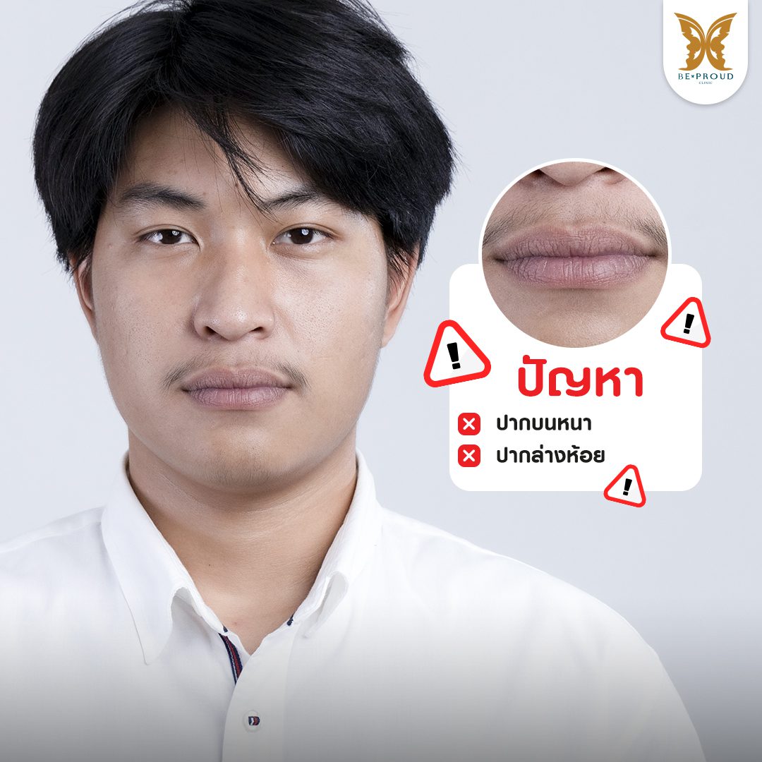 ปากกระจับผู้ชาย