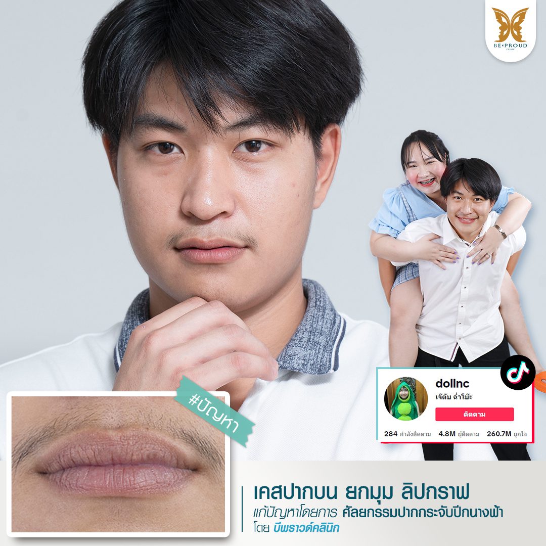 ปากกระจับผู้ชาย