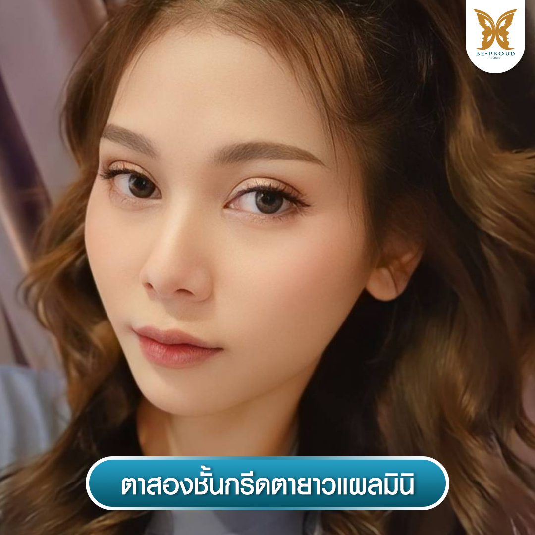 gallery-item