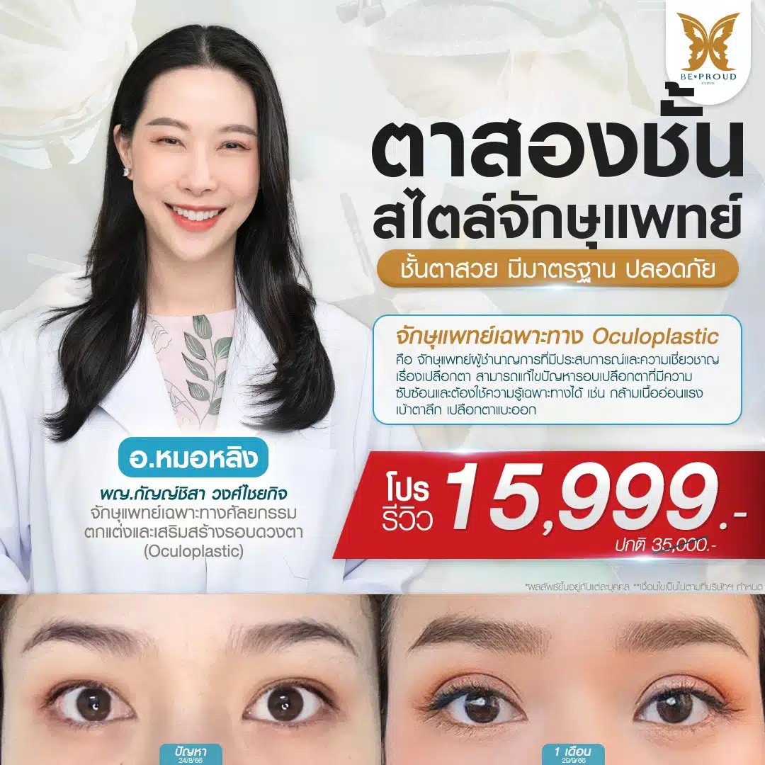 ตาสองชั้น สไตล์จักษุแพทย์บีพราวด์