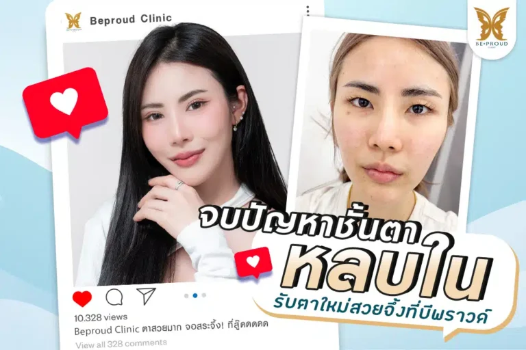 ภาพปกบทความรีวิวตาสองชั้น แก้ปัญหาชั้นตาหลบใน ลูกค้ารับตาใหม่สวยจึ้ง ที่บีพราวด์คลินิก