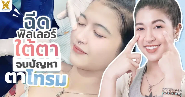 ดาวTIKTOK ฉีดฟิลเลอร์ใต้ตา บอกลา ใต้ตาดำ ตาแพนด้า
