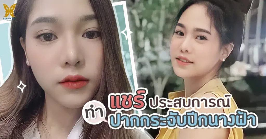 แชร์ประสบการณ์ ทำปากกระจับปีกนางฟ้า