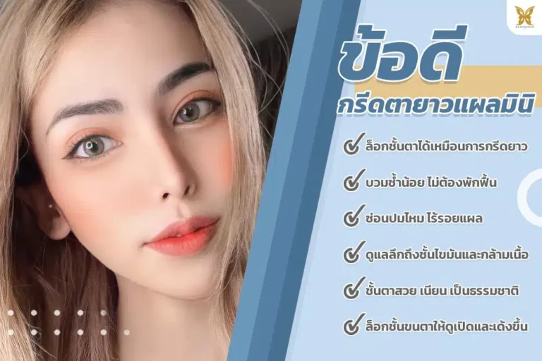 ข้อดี ตาสองชั้นกรีดยาวแผลมินิ