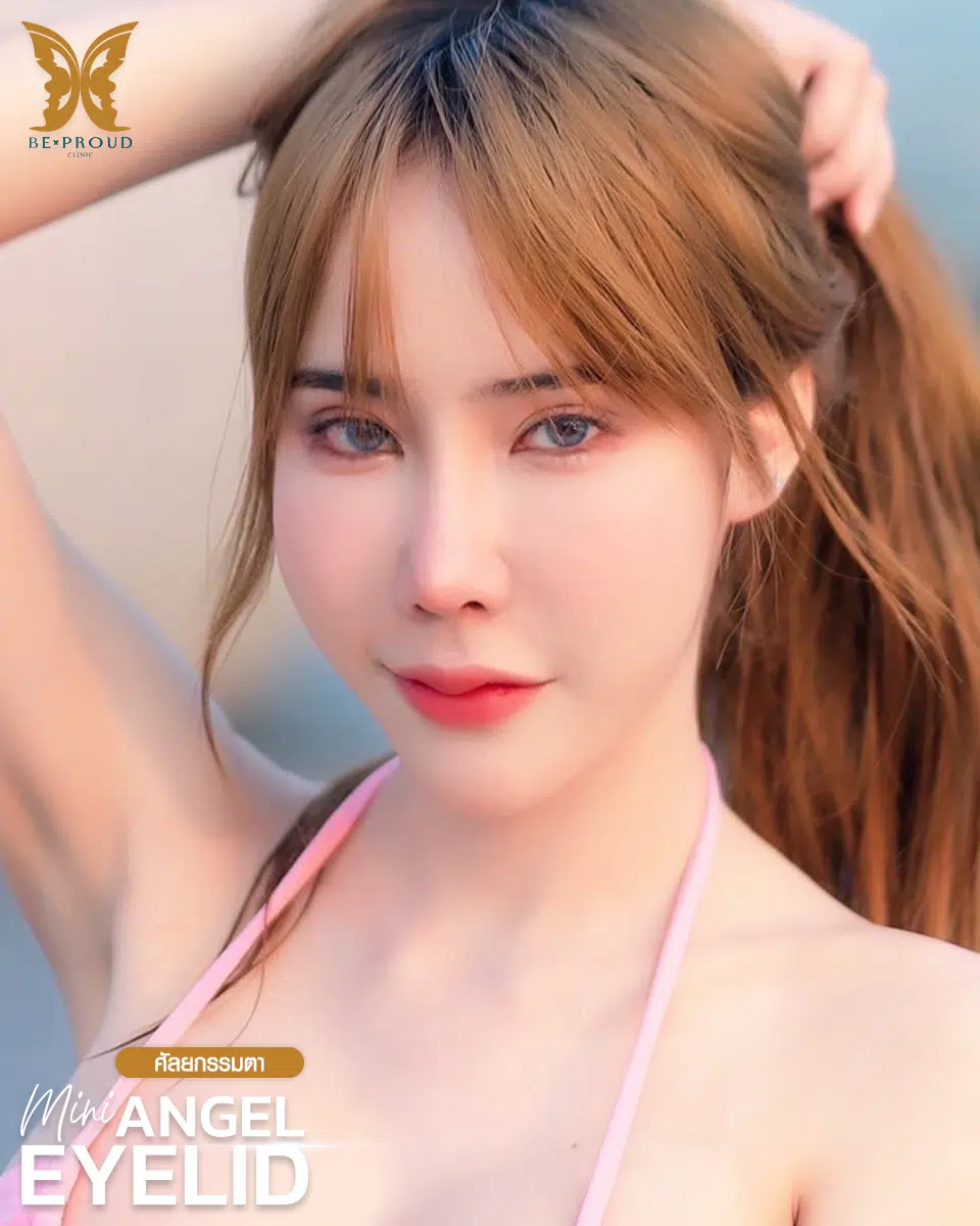 ตาสองชั้นกรีดยาวแผลมินิ