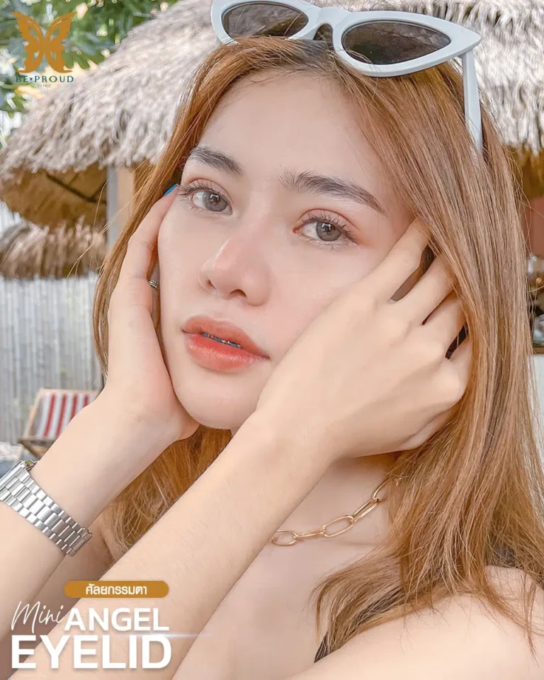 ตาสองชั้นกรีดยาวแผลมินิ