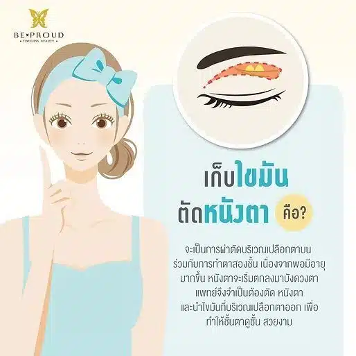 การตัดหนังตาและเก็บไขมัน