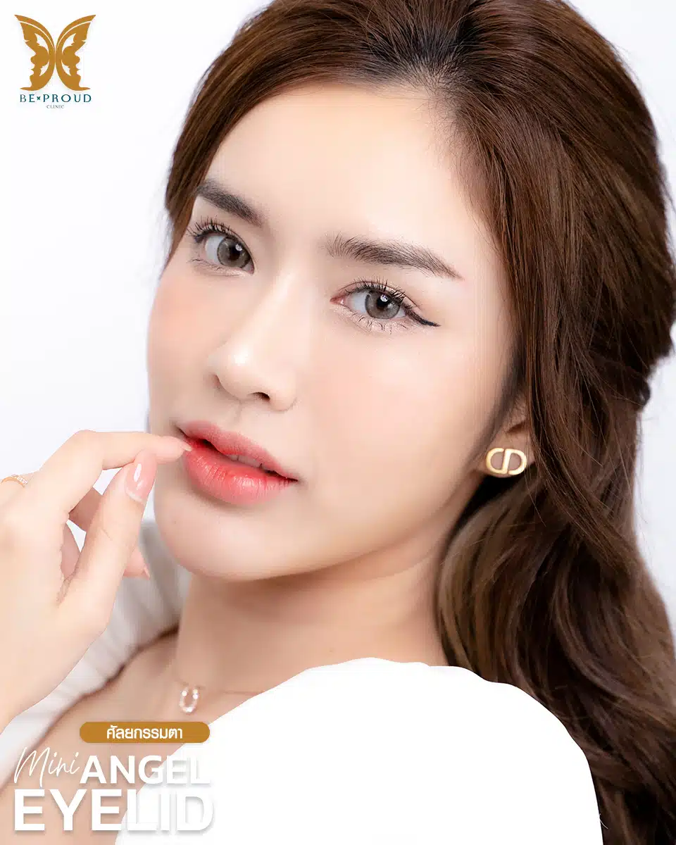 ตาสองชั้นกรีดยาวแผลมินิ