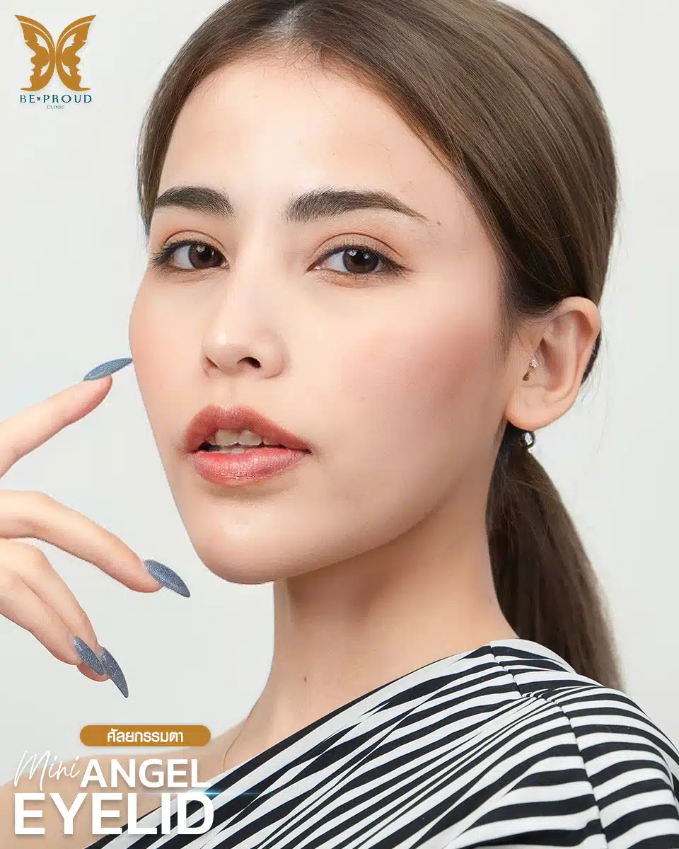 ตาสองชั้นกรีดยาวแผลมินิ