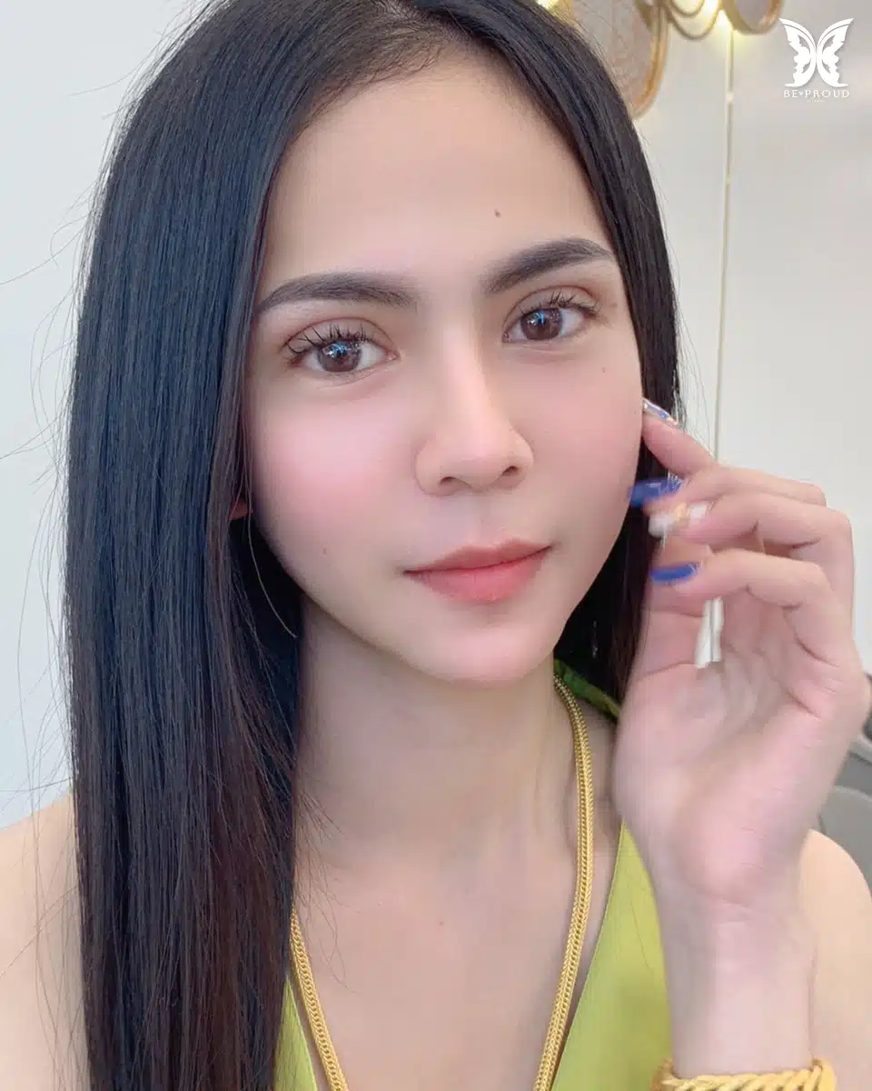 ตาสองชั้นกรีดยาวแผลมินิ