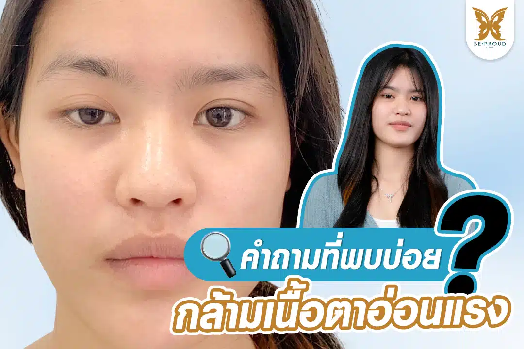 แก้กล้ามเนื้อตาอ่อนแรง