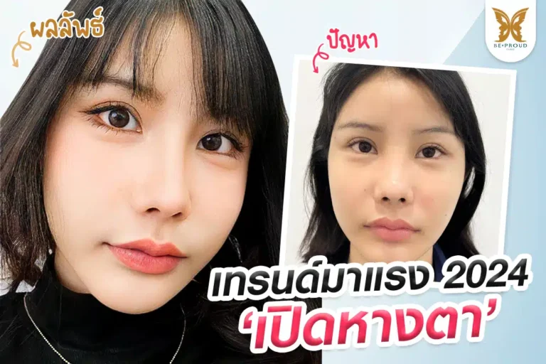 เทคนิคพิเศษ เปิดหางตาเติมเต็มตาสวย