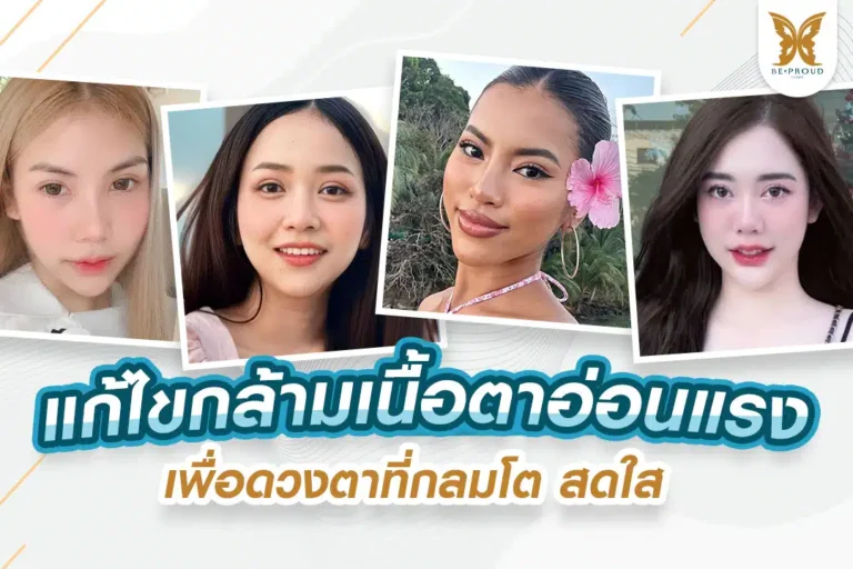 แก้กล้ามเนื้อตาอ่อนแรง
