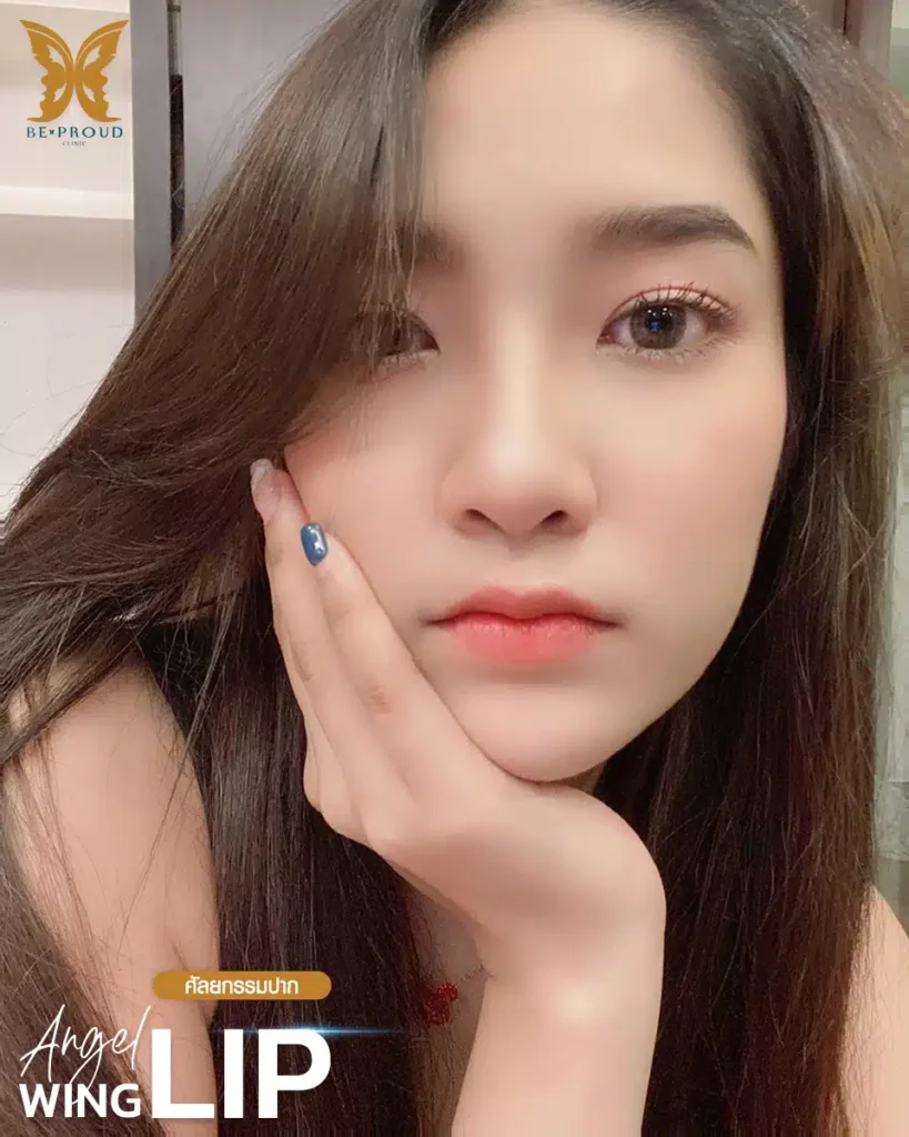 ปากกระจับปีกนางฟ้า บีพราวด์