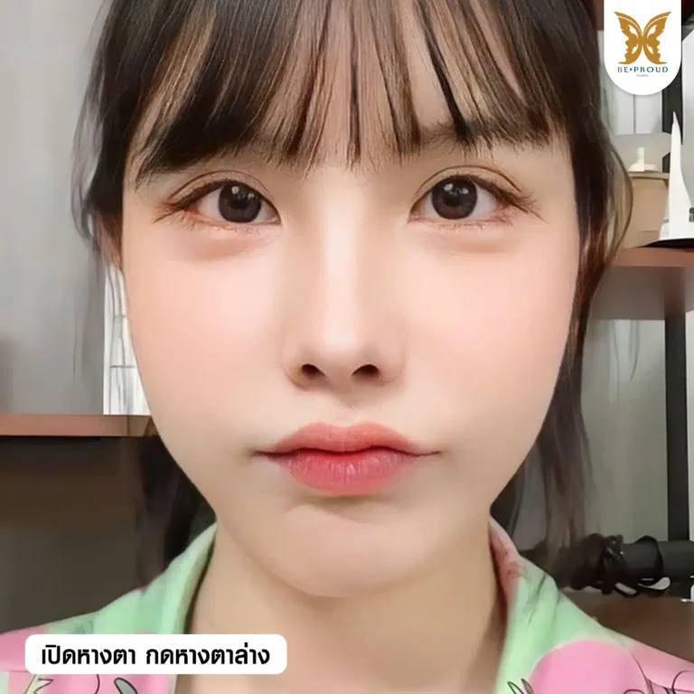 เปิดหางตา กดหางตาล่าง