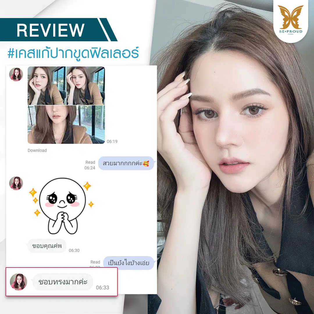 รีวิวแก้ปากขูดฟิลเลอร์