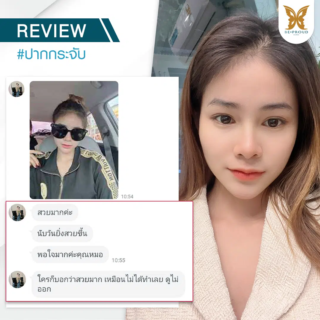 รีวิวปากกระจับ