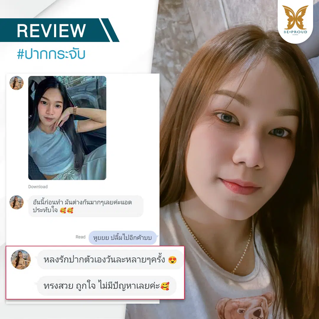 รีวิวปากกระจับ