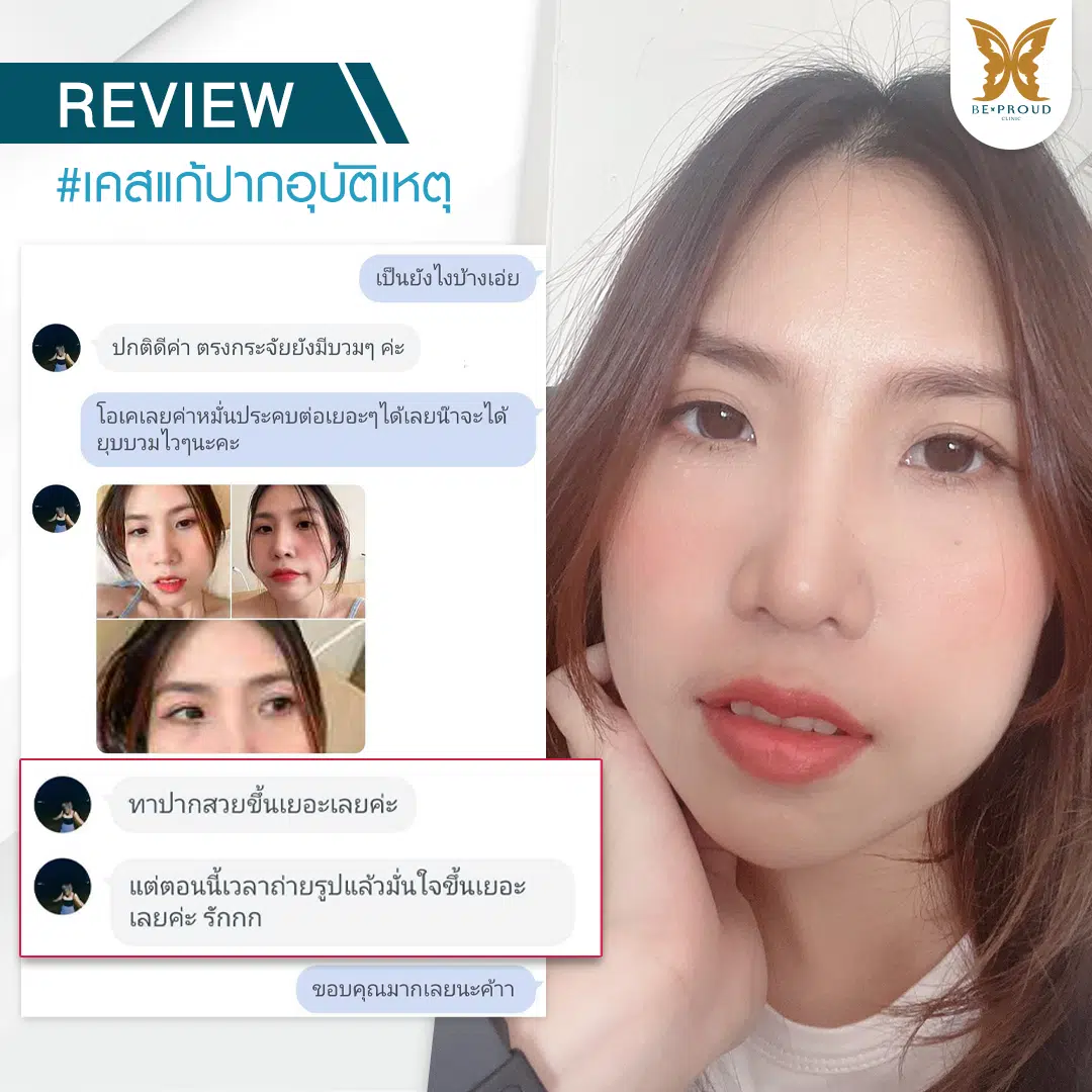 แก้ปากอุบัติเหตุ