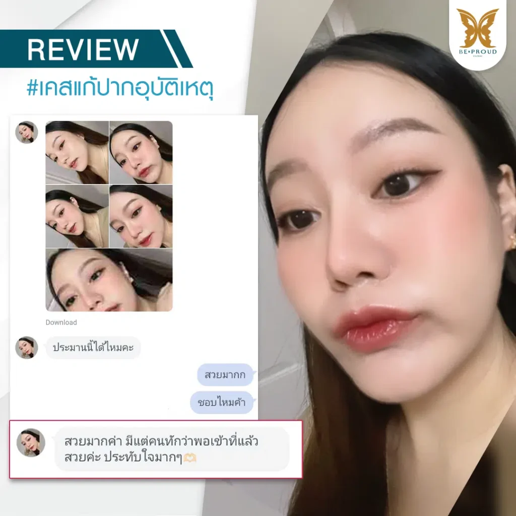 แก้ปากอุบัติเหตุ