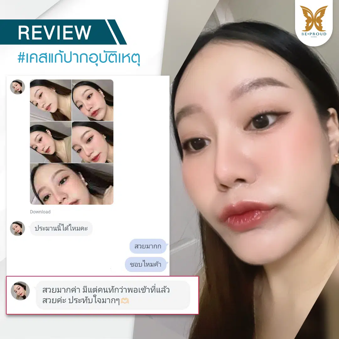 แก้ปากอุบัติเหตุ