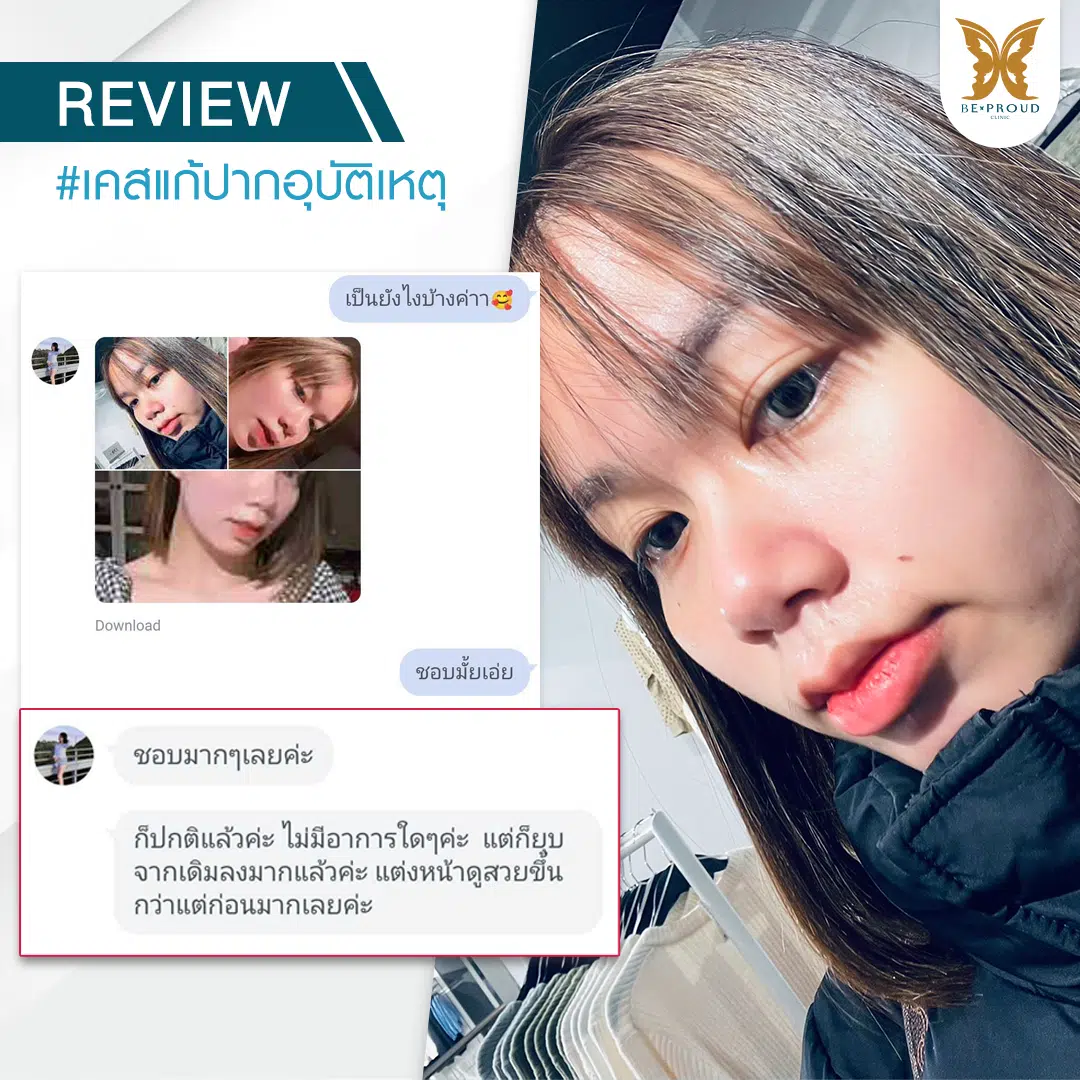 แก้ปากอุบัติเหตุ