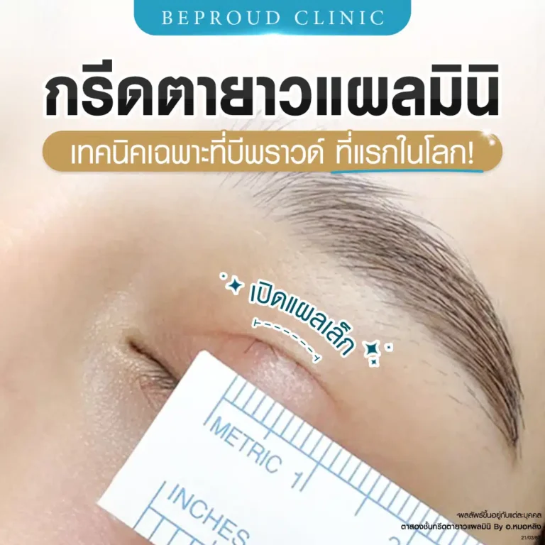 ภาพแสดงการวัดรอยกรีดตาที่เล็กมาก เทคนิคกรีดตายาวแผลมินิ ที่บีพราวด์คลินิก