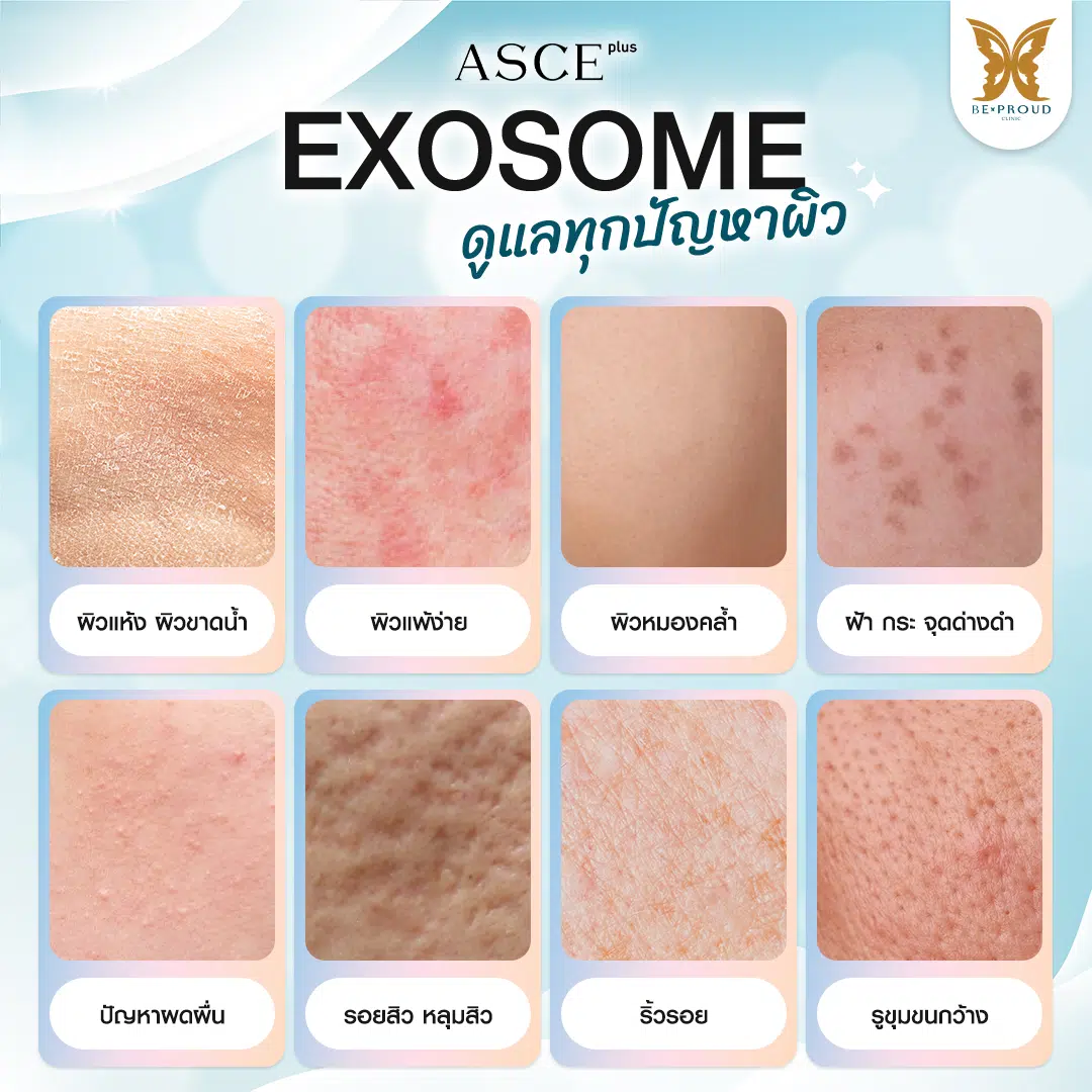 Exosome Skin Booster
