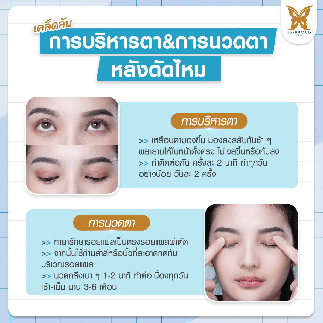 ศัลยกรรมตาสองชั้น บริการ - ตาสองชั้นกรีดยาวแผลมินิ - ไทย