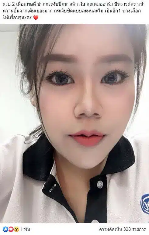 ปากกระจับ บีพราวด์คลินิก