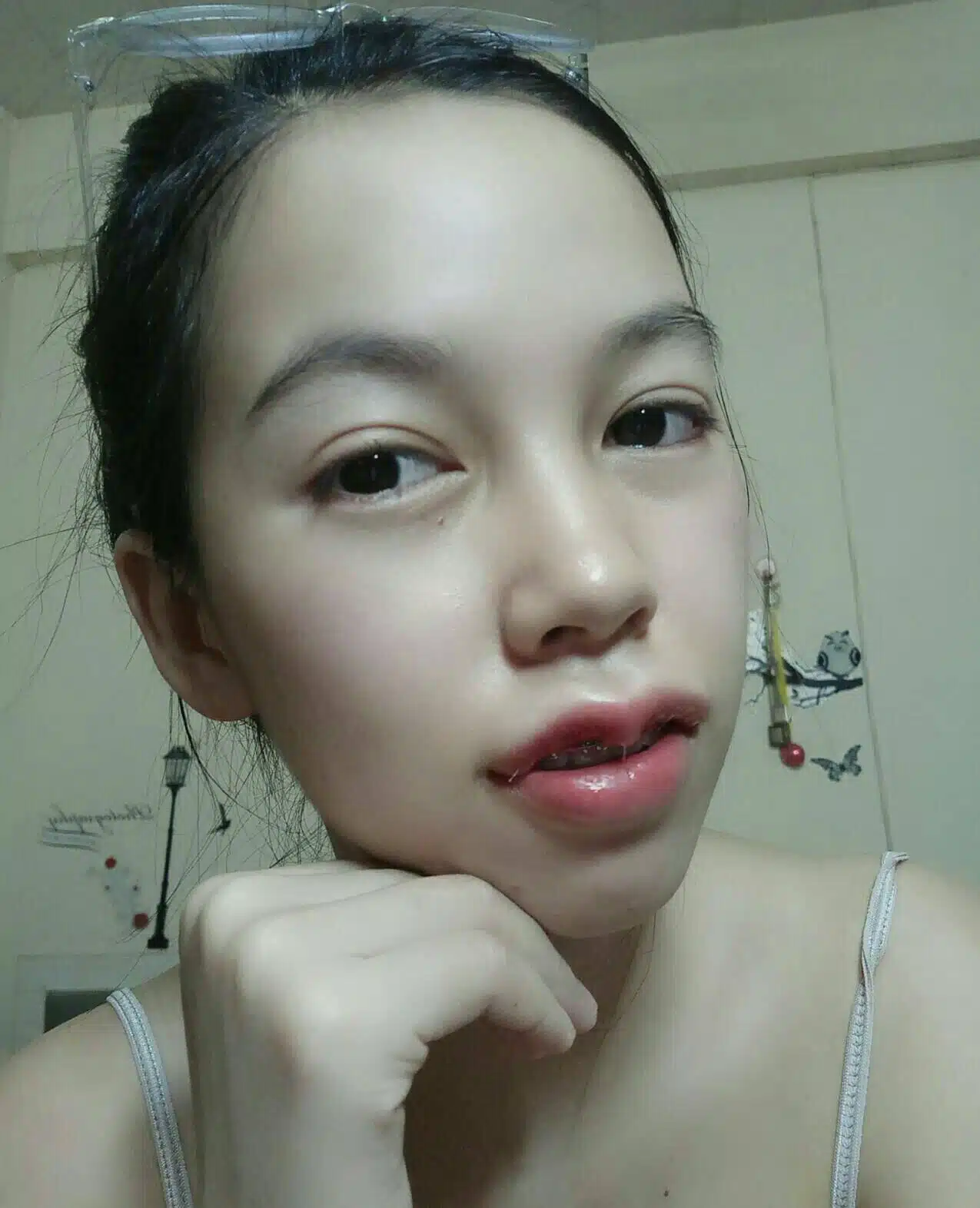 ปากกระจับหลังทำทันที บีพราวด์