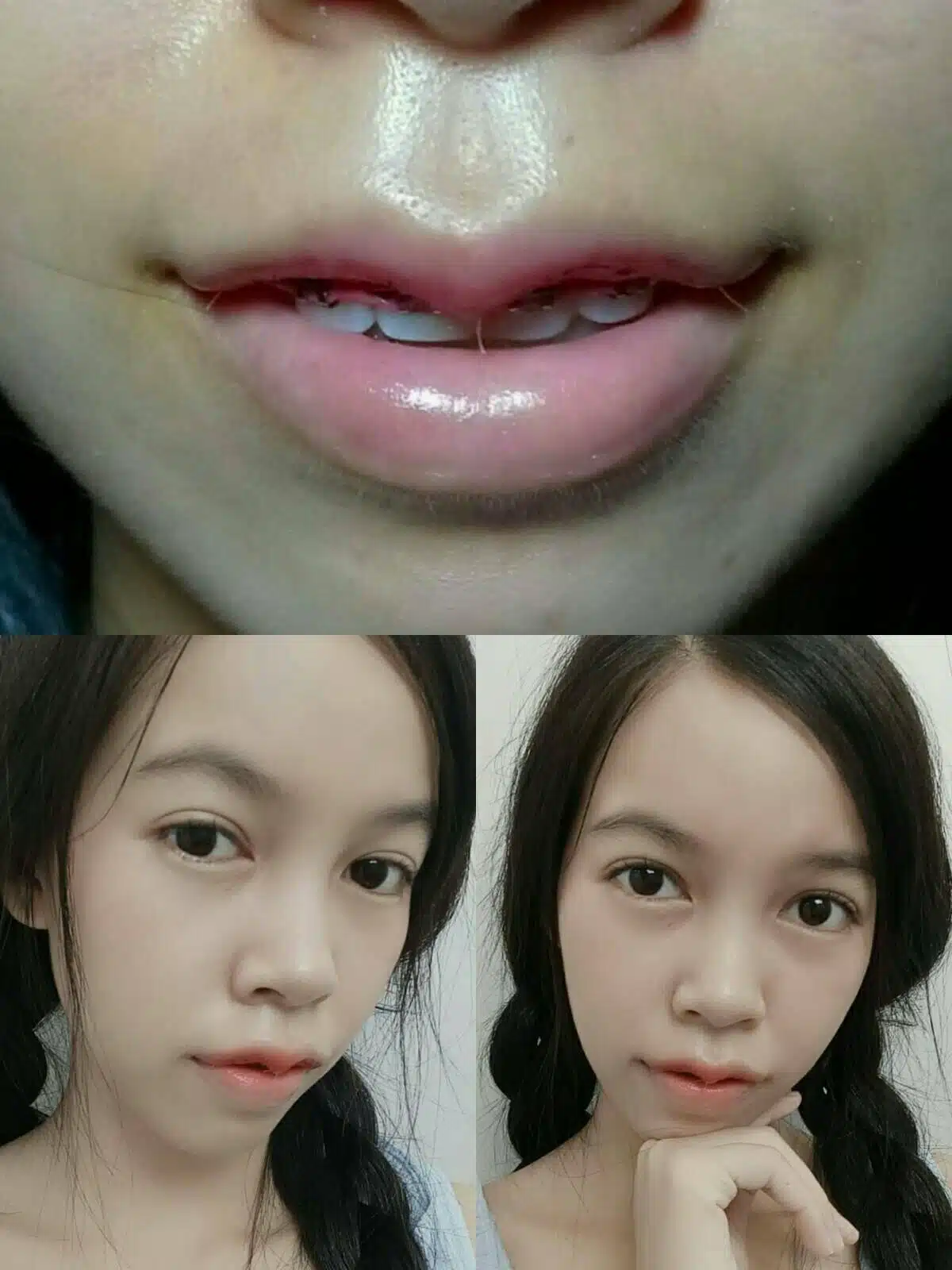 ปากกระจับ บีพราวด์