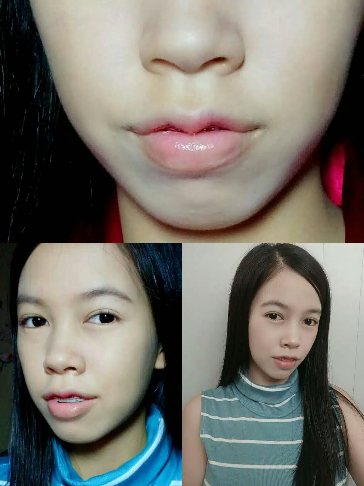 ปากกระจับ บีพราวด์