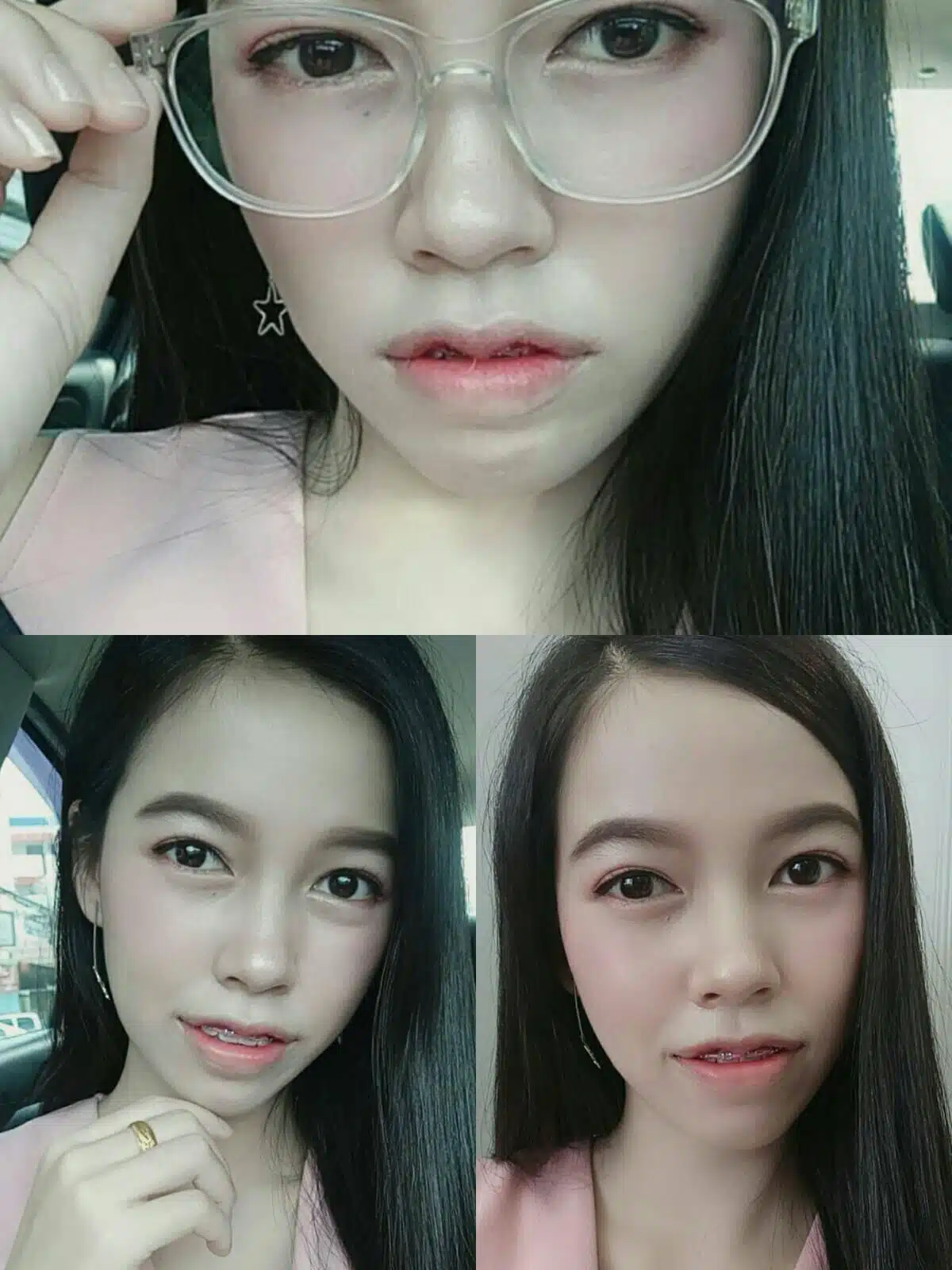ปากกระจับ บีพราวด์