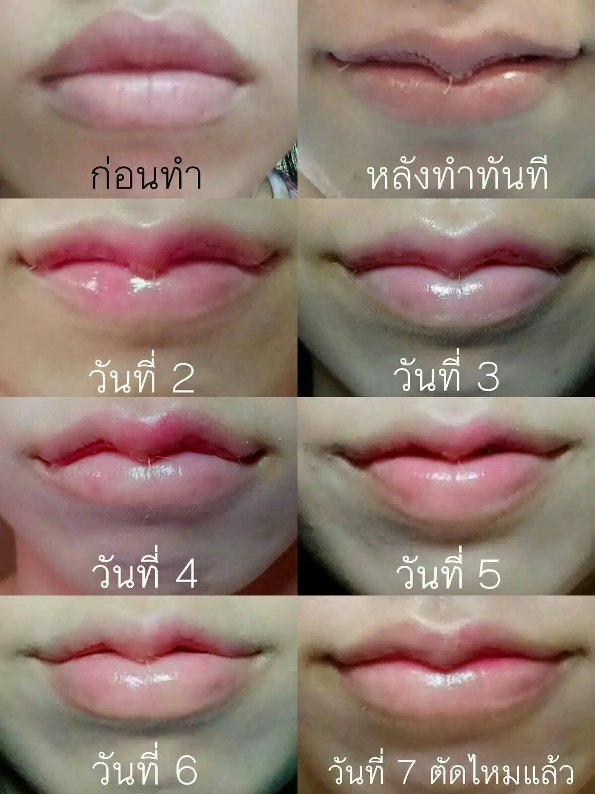 ปากกระจับ บีพราวด์