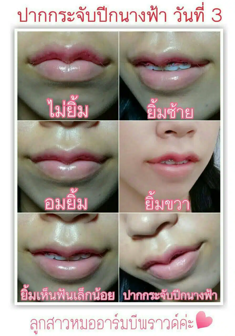 ปากกระจับ บีพราวด์