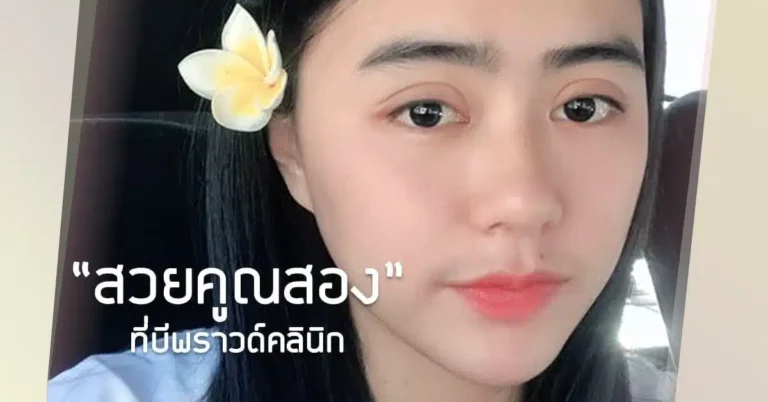 รีวิวประสบการณ์ทำศัลยกรรมสองอย่าง