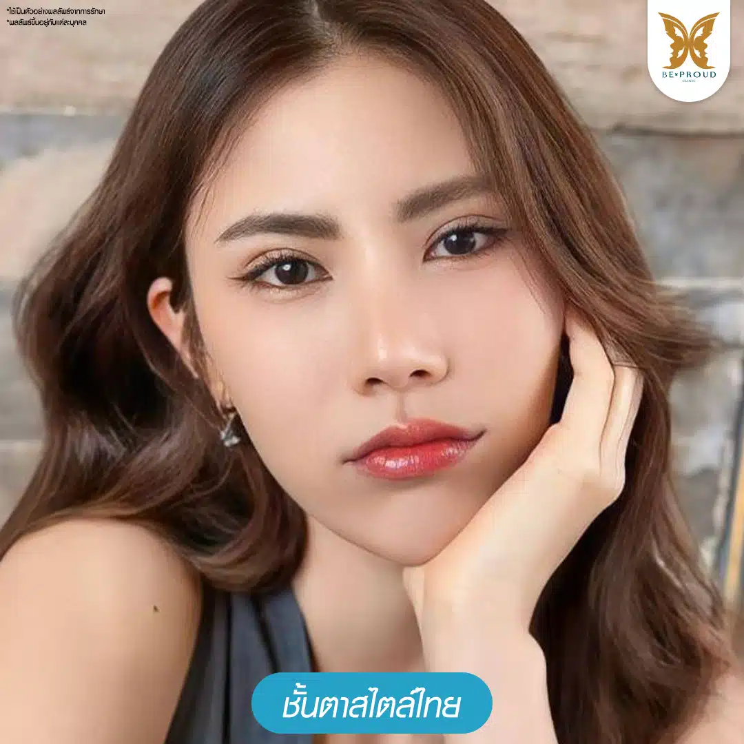 ตาสองชั้นเกาหลี บีพราวด์