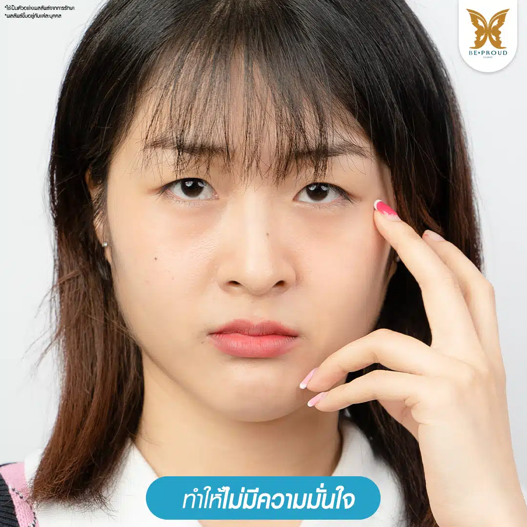 ปัญหาตาชั้นเดียว ตาตี่