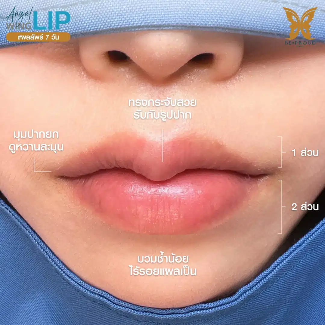 ปากกระจับ