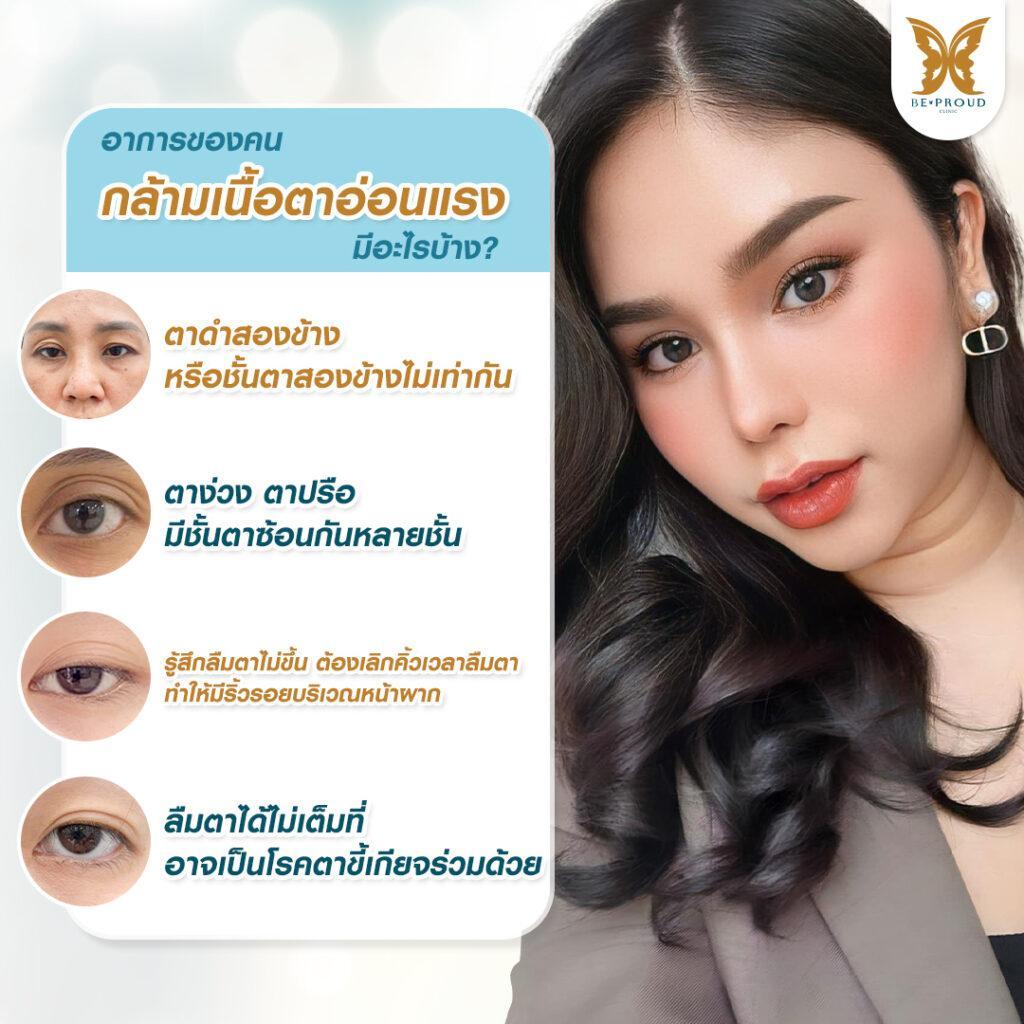 ตาสองชั้น เทคนิค แก้กล้ามเนื้อตาอ่อนแรง ทำให้ดวงตาเปิดกว้างและดูสดใสขึ้น ที่ บีพราวด์ คลินิก