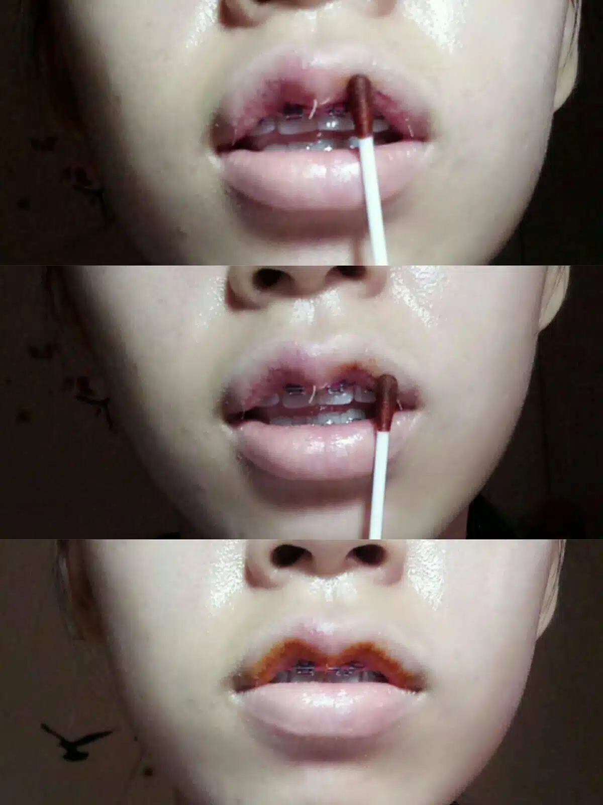 วิธีการล้างแผล