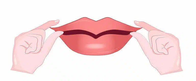 การดูแลตัวเองหลังผ่า