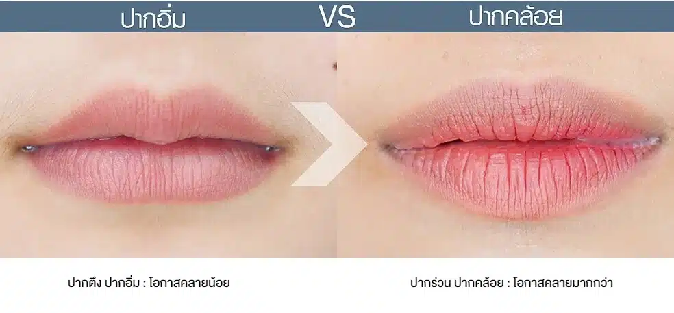 ปากอิ่มvsปากคล้อย