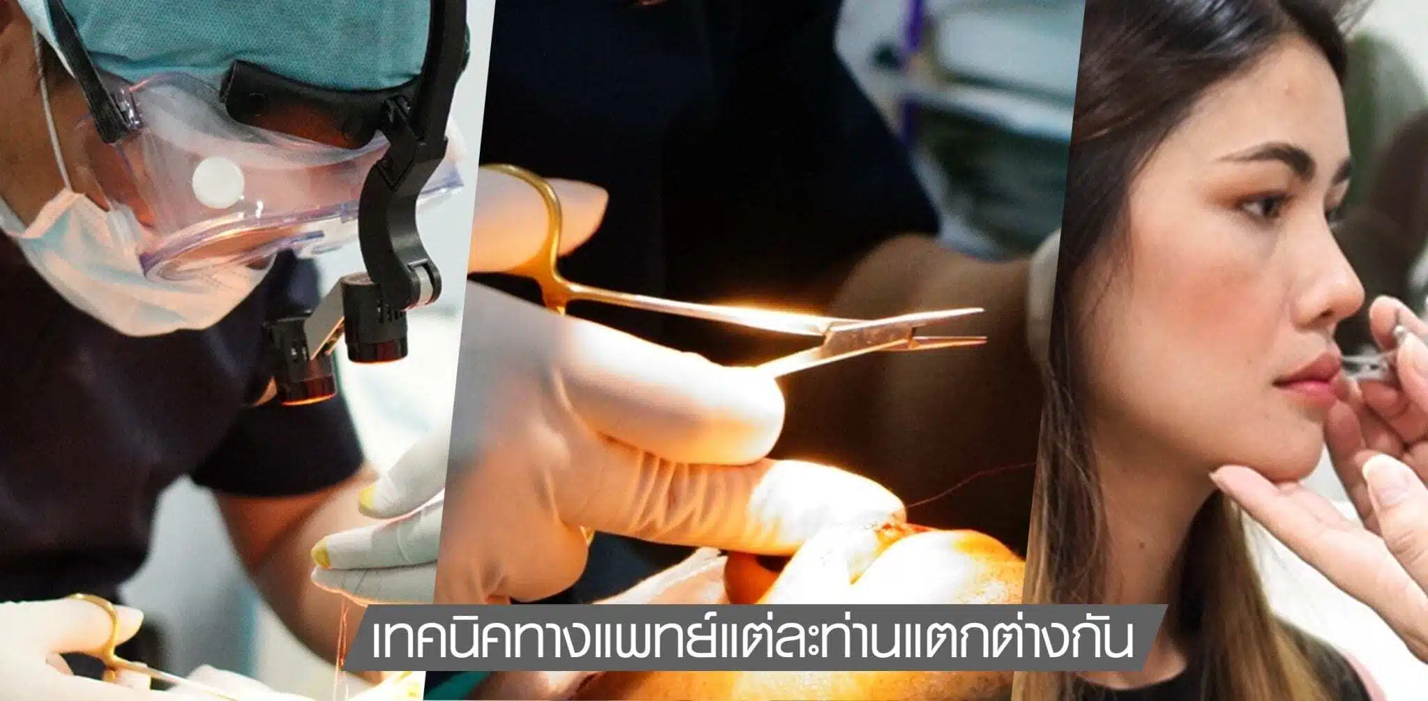 เทคนิคของแพทย์แต่ละท่าน มีความแตกต่างกัน