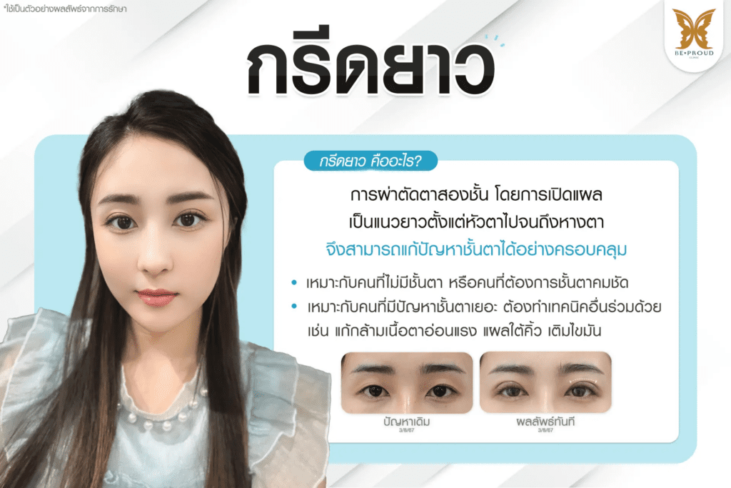 เทคนิคพิเศษตา กรีดยาว
