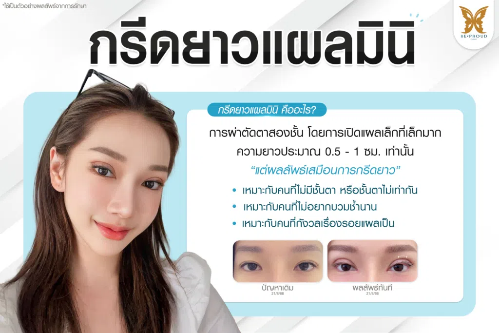 เทคนิคพิเศษตา หมอหลิง
