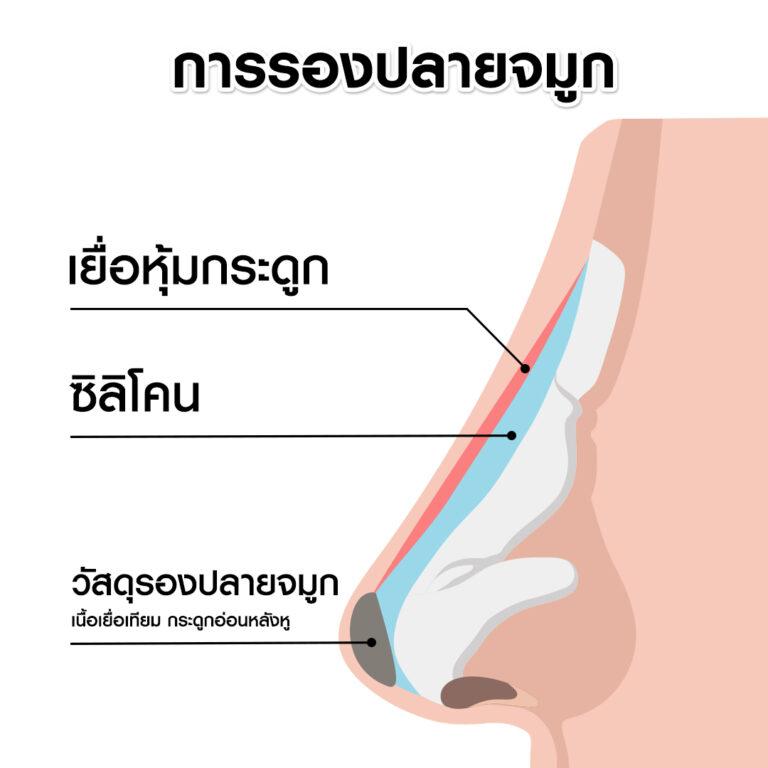 หัตถการเสริมจมูกบีพราวด์ คลินิก