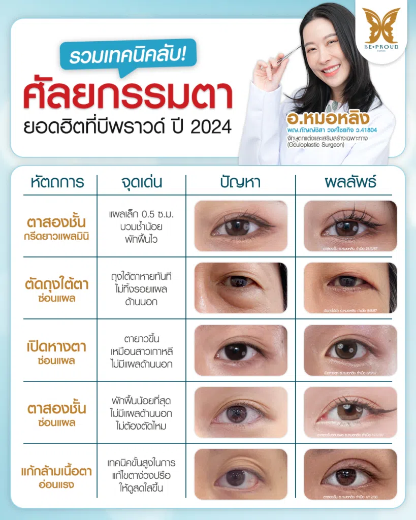 เทคนิคพิเศษตา หมอหลิง